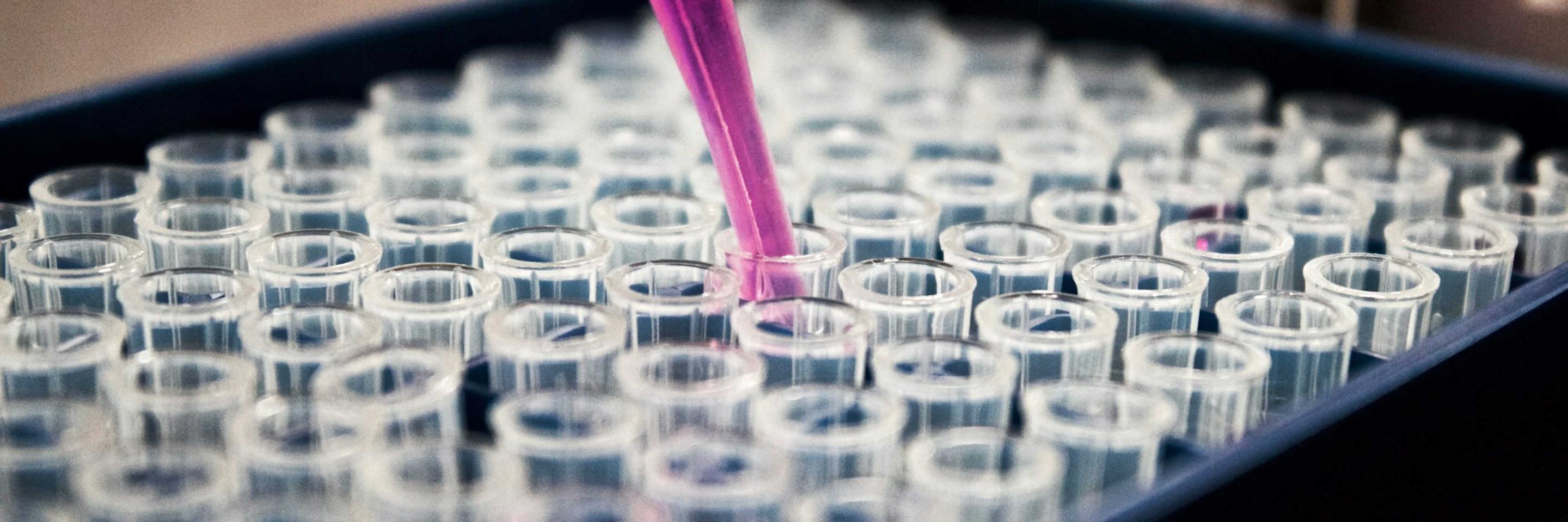 Louis reed pwc KF7 L4 no unsplash